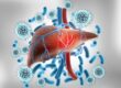 Hepatitis C