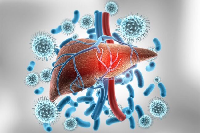 Hepatitis C